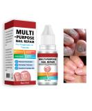 Fungal Nail Treatment for Toenails Extra Strong Nail Fungus Treatment for Toenail Toenail Fungus Treatment Nail Repair for Fingernails Toenails Strengthen Renew Damaged Broken Nails - Buy Online on GoSupps.com