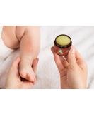 Sandalwood's Organics Healing Salve - Natural Calendula Ointment for Baby | Diaper Rash, Minor Burn, Chafing Relief | Moisturizing Balm with Marigold, Lavender, Coconut Oil, Beeswax - Yellow - Buy Online on GoSupps.com