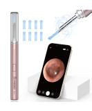 Vitcoco 1920p WiFi Otoscope - IP67 Waterproof Ear Wax Removal Camera for Adults Children & Pets - 360 Wide Angle 6 LED - Pink - Buy Online on GoSupps.com