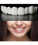 Shop Confident Smile Temporary Cosmetic Solutions for Men & Women - Instant Beauty Boost - Buy Online on GoSupps.com