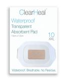 Waterproof Transparent Island Dressing Bandages - 10cm x 12cm x 10pcs, Sterile & Breathable for Swimming, Wounds, HRT, Cesarean, C-Section Scar - Buy Online on GoSupps.com