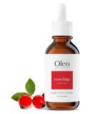 Organic Rosehip Seed Oil 100% Pure - Cold Pressed & Unrefined Facial Moisturizer Hair & Body Nourisher (60ml) - Shop Internationally - Buy Online on GoSupps.com