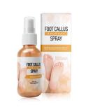 Tongyend Foot Peeling Spray Instant Foot Peeling Spray Foot Callus Removal Spray Moisturizing Hydrating Nourish Peel off Spray Foot Exfoliating Spray Remove Foot Dead Skin-30ML FootCallusRemover - Buy Online on GoSupps.com