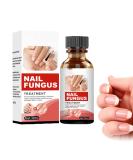 TLOPA Intense Nail Growth and Strengthening Serum 7 Days Nail Growth and Strengthening Serum Nail Serum Repair Essence for Damaged Nails (1Pcs) - Buy Online on GoSupps.com