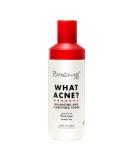 The Creme Shop WHAT ACNE Balancing Toner - Clarifying Formula with Witch Hazel & Green Tea | Made in Korea - Best for Acne Prone Skin - Buy Online on GoSupps.com