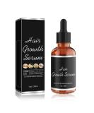 Natural Hair Growth Serum - Nourish & Thicken Thinning Hair 1 Fl Oz - Treat Hair Loss Naturally - Buy Online on GoSupps.com