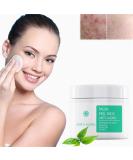 35% Glycolic Acid Peel Pads Exfoliating Face & Body Wipes with B5 & Tea Tree Oil for Pore Minimizing & Even Skin Tone - 1Pcs 2.82oz - Buy Online on GoSupps.com