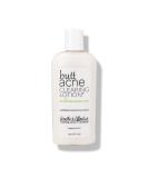 Butt Acne Clearing Lotion for Body  Back  Bum  & Thigh - Special Acne Treatment Cream Formula Clears Pimples  Spots  Ingrown Hairs  Razor Burn  Bumps  Blackheads  and Blemishes. Vegan & Cruelty Free. - by Green Heart Lab... - Buy Online on GoSupps.com