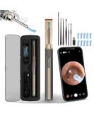 Wohlmen Ear Wax Removal Kit with 1920HD Camera- Wireless, iPhone & Android Compatible for Adults & Kids - Buy Online on GoSupps.com