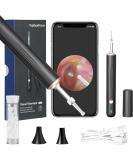TopQuaFocus Earwax Removal Kit - Electric Otoscope with 6 LED Lights & 1000P HD Camera | Wireless Ear Scope for Kids & Adults | Easy Ear Cleaning & Pediatric Wax Remover - Buy Online on GoSupps.com
