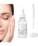Niacinamide Serum for Face - 10% Niacinamide + 1% Zinc | Best Acne Treatment - 30ML - Buy Online on GoSupps.com
