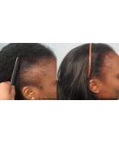Black Seed Oil for powerful Hair growth - Thick and Full - Buy Online on GoSupps.com
