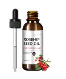 100% Cold Pressed Rosehip Seed Oil - Organic Moisturizer for Face & Skin | Anti-Aging Fine Lines & Wrinkles Reduction | Perfect for Women s Massage Hair & Body - Buy Online on GoSupps.com