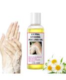 Extra Strong Peeling Oil for Dark Skin | Yellow Exfoliating Solution for Hand & Feet | Chemical Peel for Face | 110ML | Ships Internationally - Buy Online on GoSupps.com
