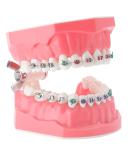 Buy Dental Demonstration Orthodontic Model with Metal Wires & Bracket - Ideal for Teaching Brushing & Flossing Practices - Buy Online on GoSupps.com