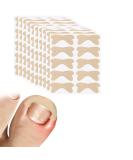 Ingrown Toenail Treatment - 100Pcs Breathable Corrector Patches & Strips | Pain-Free Nail Correction Durable Light Brown Stickers for Effective Ingrown Nail Care - Buy Online on GoSupps.com