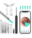 Vohesea Ear Wax Removal Otoscope - 1296P HD WiFi Ear Cleaner for Adults & Kids | Waterproof 3.6mm Lens 6 LEDs | Compatible with iPhone iPad Android - Buy Online on GoSupps.com