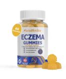 Buy Sugar-Free Eczema Treatment Gummies | USA-Made 10x Effective 20+ Vitamins for Eczema Psoriasis & Dermatitis - Healthy Skin Relief (60 Gummies - Buy Online on GoSupps.com