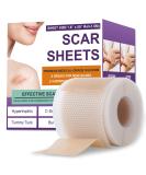 Silicone Scar Sheets & Tape | Effective Scar Removal for Surgical & Keloid Scars - 1.6 x 59 Roll (1.5M) - Fast International Shipping - Buy Online on GoSupps.com
