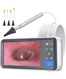 ScopeAround Ear Wax Removal Camera with 4.5" IPS Screen, 1920x1080 FHD Smart Visual Ear Cleaner with Camera Tool Kit, Plug & Play at Home Ear Infection Detector Ear Wax Remover Otoscope with Light - Buy Online on GoSupps.com