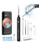 Hopefox 1080P Ear Wax Removal Kit Camera | WiFi Otoscope for iPhone, iPad & Android | 6 LED Lights | Ear Cleaning Tool with Dust Cover - Buy Online on GoSupps.com