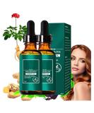 GFOUK Scalp Folliculitis Therapy Oil Folliculitis Scalp Oil Nourishing Treatment for Hair Scalp Therapy Oil Nourishing Treatment for Split Ends and Dry Scalp for All Hair Types (2PC) - Buy Online on GoSupps.com