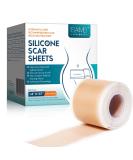 Silicone Scar Roller Tape - Reusable 4m x 4.6cm for Scar Removal & Keloid Treatment - Ideal for Caesarean Scars & Facial Scarring - Buy Online on GoSupps.com