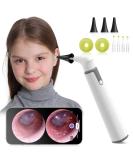 Anykit Wireless Otoscope Ear Camera - Dual View 3.9mm 720PHD WiFi Ear Scope with Ear Wax Removal Tool for Kids, Adults & Pets - Compatible with Android and iPhone - Buy Online on GoSupps.com