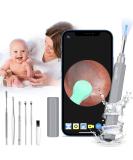 Blumway WiFi Ear Otoscope 3.5mm 1080p HD Camera - Ear Cleaner & Wax Removal Tool for Babies Children & Adults - iOS & Android Compatible - Gray - Buy Online on GoSupps.com