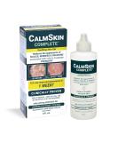 Xenna CalmSkin Complete Gel for Psoriasis Relief | Clinically Proven | Results in 1 Week | Calming Formula | 4 fl. oz - Buy Online on GoSupps.com