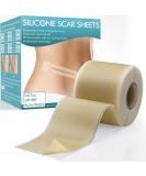 Silicone Scar Sheets 1.6 x 60 Roll - Reusable Easy-Tear Scar Removal Tape for C-Section, Burn, Keloid - Effective on Old & New Scars - Buy Online on GoSupps.com