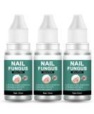 Extra Strong Fungal Nail Treatment for Toenails - Nail Repair Oil for Ingrown Nails - Strengthen and Renew Damaged Nails - 3Pcs Set - Buy Online on GoSupps.com