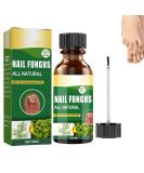 Antifungal Nail Treatment for Toe Fungus - 2-in-1 Solution to Treat and Prevent Nail Fungal Infections - Buy Online on GoSupps.com