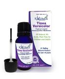 Naturasil Tinea Versicolor Topical Treatment 15mL | Also Helps Eliminate Candida & Onychomycosis - Buy Online on GoSupps.com