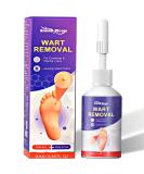 Maximum Strength Wart Remover Liquid with Salicylic Acid - Fast-Acting Wart Treatment for Common Plantar & Genital Warts - 0.68 floz/20ml - Buy Online on GoSupps.com