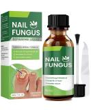 Extra Strength Toenail Fungus Treatment - 30ml | Effective Nail Fungus Solution for Thick Broken & Discolored Nails - Fast Shipping Internationally - Buy Online on GoSupps.com