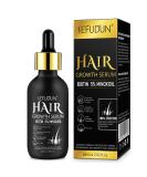 5% Minoxidil Hair Growth Serum - Biotin Hair Regrowth Treatment for Thinning Hair & Scalp Loss | 60ml/2oz 1 Month Supply - Buy Online on GoSupps.com