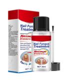 Extra Strong Fungal Nail Treatment 20ml - Premium Toenail and Fingernail Fungus Eliminator - Anti-Fungal Repair and Strengthening - 1 PCS - Buy Online on GoSupps.com