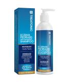 Best Eczema & Psoriasis Shampoo | Seborrheic Dermatitis & Scalp Treatment - International Shipping - Buy Online on GoSupps.com