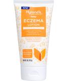 Hyland's Baby Eczema Lotion | Lightweight Moisturizer with Colloidal Oatmeal | Soothes Eczema-Prone Skin | 5 oz International Shipping - Buy Online on GoSupps.com