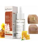 ILOVMUP Nail Cuticle Oil Nail Treatment for Dry & Damaged Nails Cuticle Care Oil for Fungal Nail & Toenails Strength Nail Oil for Moisturizing and Repairing Cracked Nail - 20ml - Buy Online on GoSupps.com