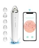 FDA Certified Blackhead Remover Pore Vacuum with WiFi Camera and 6 Suction Heads - Electric Facial Cleanser for Pimple Acne Extraction - White - Buy Online on GoSupps.com