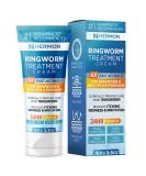 Hermon Antifungal Ringworm Cream - 100ml | Treat Ringworm Jock Itch Eczema & Athlete's Foot for Adults & Kids - Buy Online on GoSupps.com