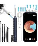 Ear Wax Removal Kit - 1080 HD Camera Otoscope for iPhone/Android | Smart Ear Cleaner with Light & Accessories Set - Ships Internationally - Buy Online on GoSupps.com