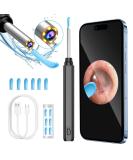 Pumwoy WiFi Ear Wax Removal Otoscope - Ear Cleaner Camera Endoscope for Adults Kids & Pets (Black) - Buy Online on GoSupps.com