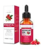 100% Pure Organic Rosehip Oil for Face Hair & Skin - Cold Pressed Anti-Aging Moisturizer Serum (30ml - Buy Online on GoSupps.com