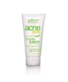 Alba Botanica Acnedote Oil Control Lotion 2 Oz - Maximum Strength Formula - Buy Online on GoSupps.com