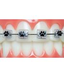 Snapcaps Paw Print 10 Ct: Bracket Cover Bumper for Braces - Orthodontic Accessories - Buy Online on GoSupps.com
