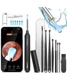 1080P HD Ear Cleaner Camera Ear Wax Removal Kit with Otoscope & 15 Ear Picks Best Ear Cleaning Tool for Adults - Buy Online on GoSupps.com
