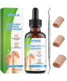 Ingrown Toenail Treatment Kit | Drops Softener & Double-Sided Pedicure Tool for Easy Care | Perfect Solution for Thick Nails & Nail Pain Relief - Buy Online on GoSupps.com